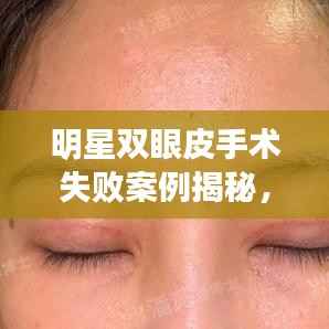 明星双眼皮手术失败案例揭秘,美丽手术的风险与警示
