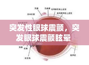 突发性眼球震颤,突发眼球震颤眩晕